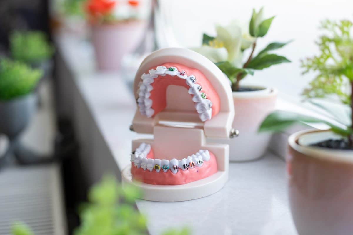 Traitements Orthodontiques : Quelles En Sont Les Différentes Phases ...